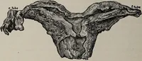Picture 140 of 178 from A text-book of pathology / by Alfred Stengel ; with 394 illustrations in the text, many of them in colors, and 7 full-page chromolithographic plates. (1903), leaf 688