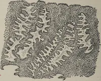 An illustration from A text-book of pathology / by Alfred Stengel ; with 394 illustrations in the text, many of them in colors, and 7 full-page chromolithographic plates. (1903)