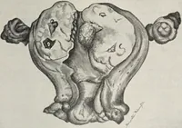 An illustration from A text-book of pathology / by Alfred Stengel ; with 394 illustrations in the text, many of them in colors, and 7 full-page chromolithographic plates. (1903)