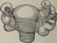 An illustration from A text-book of pathology / by Alfred Stengel ; with 394 illustrations in the text, many of them in colors, and 7 full-page chromolithographic plates. (1903)