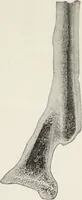 An illustration from A text-book of pathology / by Alfred Stengel ; with 394 illustrations in the text, many of them in colors, and 7 full-page chromolithographic plates. (1903)
