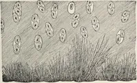 Picture 163 of 178 from A text-book of pathology / by Alfred Stengel ; with 394 illustrations in the text, many of them in colors, and 7 full-page chromolithographic plates. (1903), leaf 775