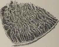 An illustration from A text-book of pathology / by Alfred Stengel ; with 394 illustrations in the text, many of them in colors, and 7 full-page chromolithographic plates. (1903)