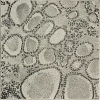 An illustration from A text-book of pathology / by Alfred Stengel ; with 394 illustrations in the text, many of them in colors, and 7 full-page chromolithographic plates. (1903)
