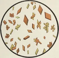 An illustration from A text-book of pathology / by Alfred Stengel ; with 394 illustrations in the text, many of them in colors, and 7 full-page chromolithographic plates. (1903)