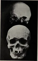 An illustration from Franz Joseph Gall / von P. J. Möbius. (1905)