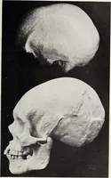 An illustration from Franz Joseph Gall / von P. J. Möbius. (1905)