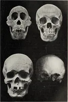 An illustration from Franz Joseph Gall / von P. J. Möbius. (1905)
