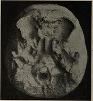 An illustration from Franz Joseph Gall / von P. J. Möbius. (1905)