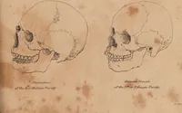 Picture 7 of 10 from Treatise on the influence of climate on the human species; and on the varieties of men resulting from it; including an account of the criteria of intelligence which the form of the head presents; and a sketch of a rational system of physiognomy as founded on physiology / By N.C. Pitta, M.D., President of the Royal Physical Society of Edinburgh, extraordinary member of the Royal Medical Society of the same city, member of the Society of Natural History there, and physician at Madeira. (1812), leaf 109